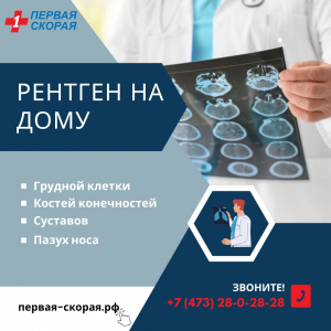 Рентген на дому